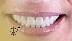 Before and After Cases: Aesthetic Rehabilitation 29 Before and After Cases: Aesthetic Rehabilitation