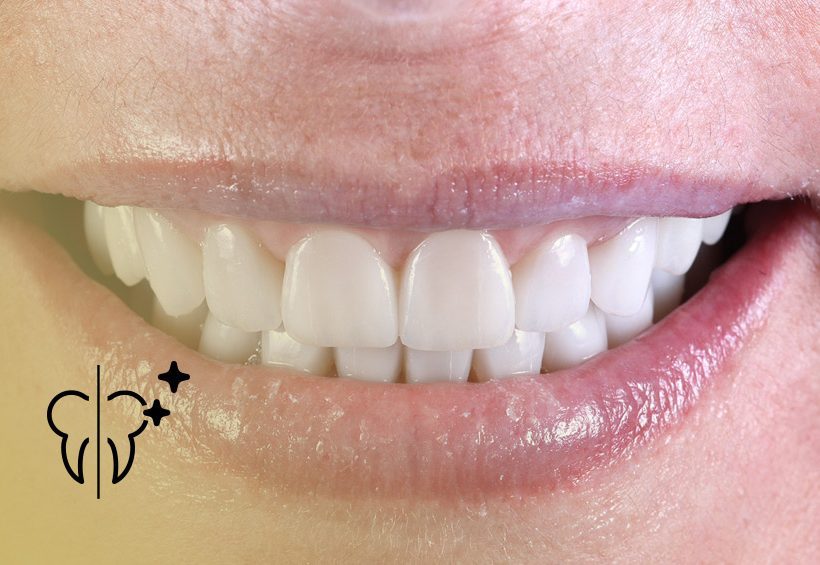 Before and After Cases: Aesthetic Rehabilitation 2 cabecera casos rehabilitacion estetica 1 Clínica Serrano Sánchez