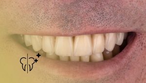 Cases Before and After: Multidisciplinary Treatment 31 Cases Before and After: Multidisciplinary Treatment