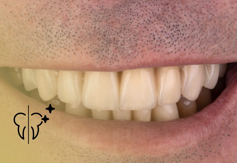 Cases Before and After: Multidisciplinary Treatment 4 cabecera casos tratamiento multidisciplinar 1 Clínica Serrano Sánchez