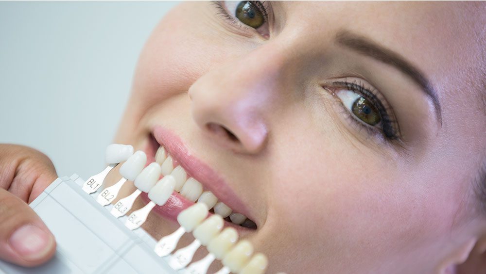 SerranoSanchez dientes carillas Clínica Serrano Sánchez