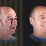 rehabilitación dental integral de lado