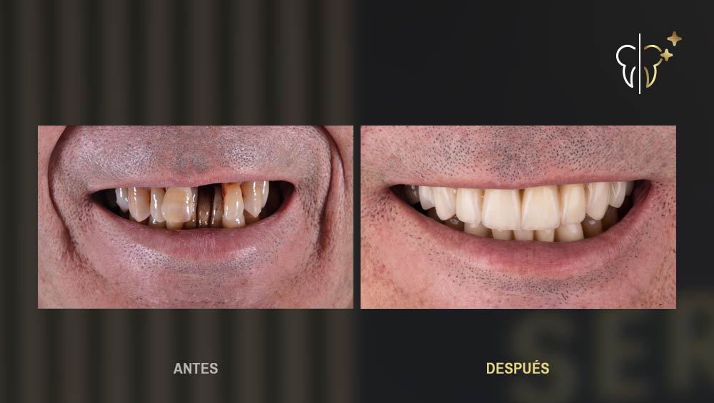 rehabilitación dental integral zoom