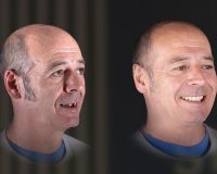 rehabilitación dental integral de lado